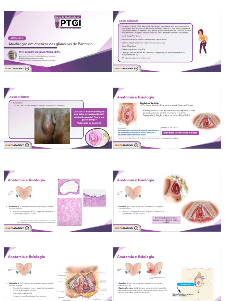Tratamento de Cistos de Bartholin | PDF | Epitélio | Especialidades médicas