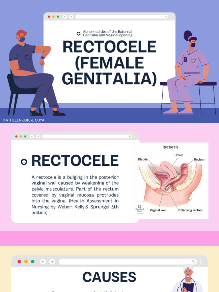 Rectocele and Hydrocele Explained | PDF