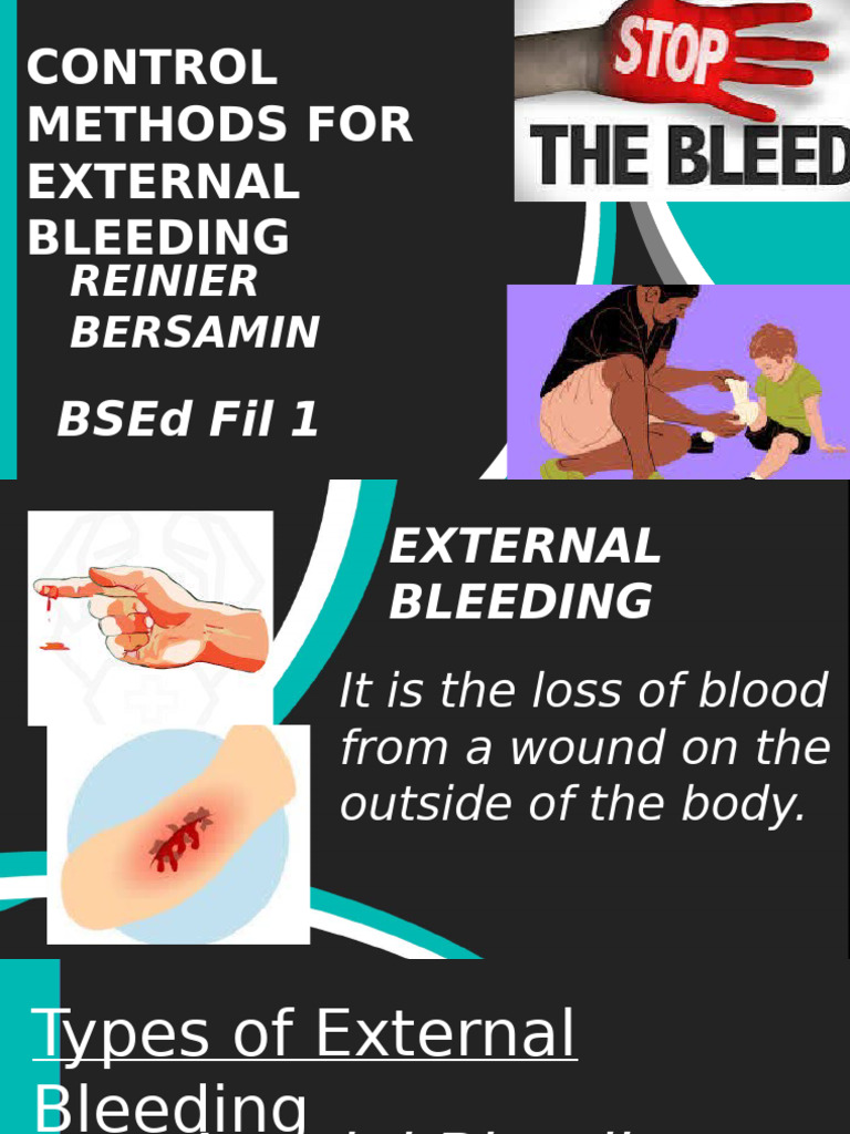 Control Methods for External Bleeding | PDF