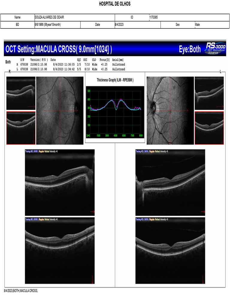 Macula Ao | PDF