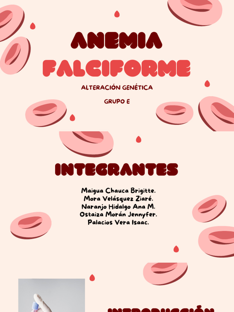 Anemia Falciforme: Causas y Tratamientos PDF