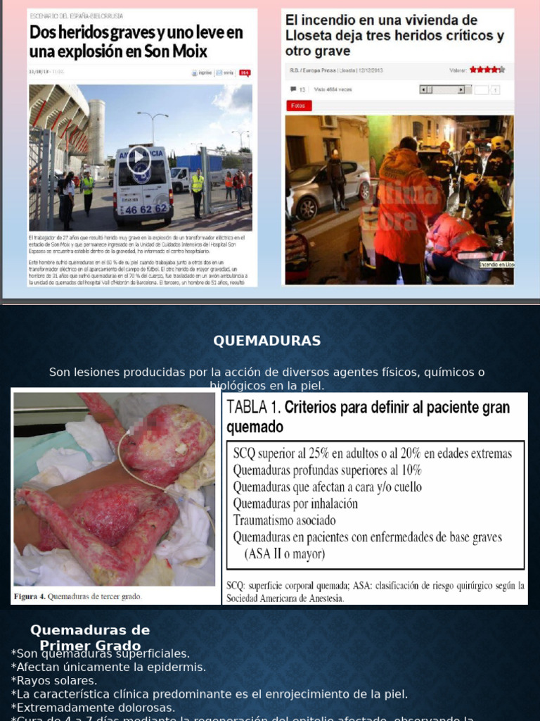 Manejo de Paciente Gran Quemado | PDF | Quemar | Piel
