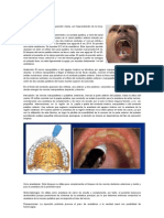 Anestesia del nervio nasopalatino y palatino