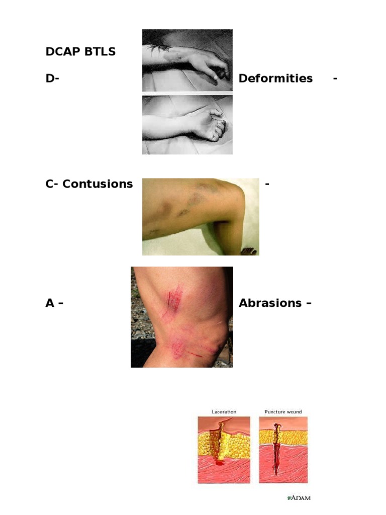 Dcap BTLS | PDF