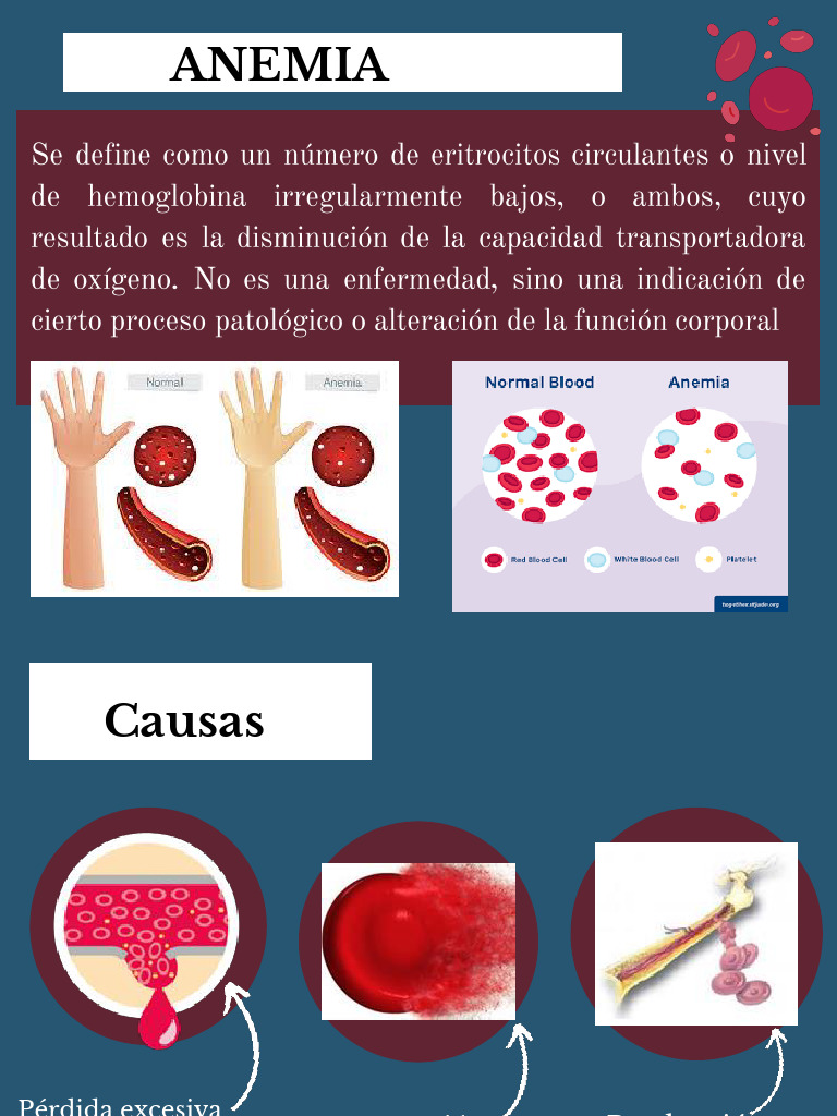 Tipos y Causas de Anemia: Guía Completa | PDF | Anemia | Glóbulo rojo