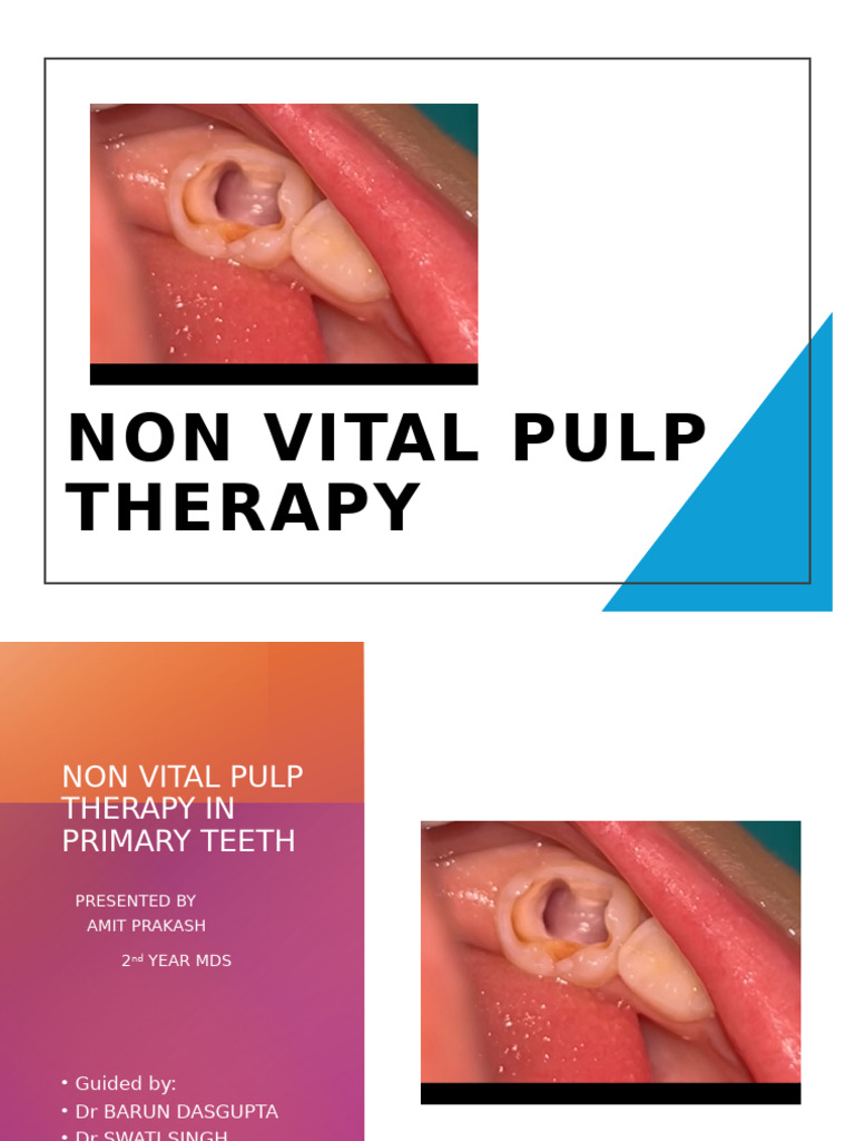 non-vital-pulp-therapy-overview-pdf-dentistry-branches
