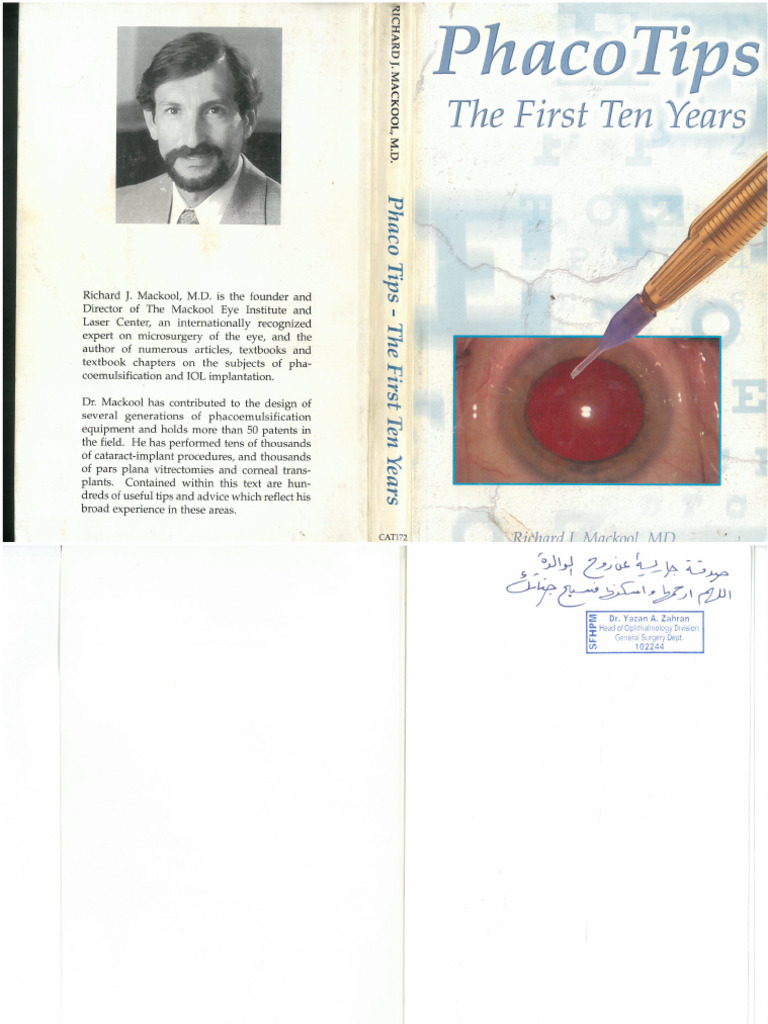 PHACO TIPS The First Ten Years | PDF