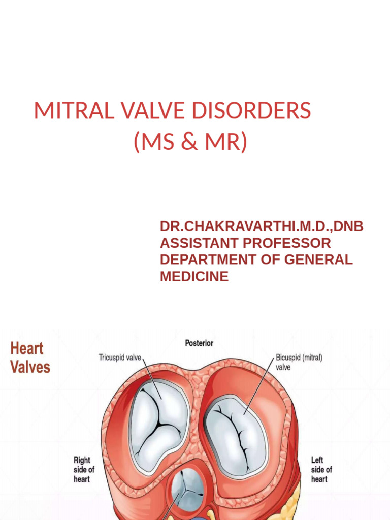 MITRAL Stenosis & Regurgitation PDF