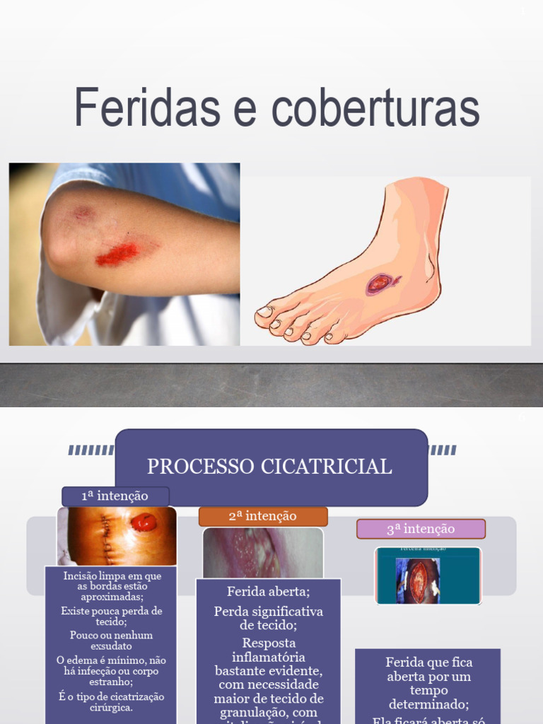 Tipos e Tratamento de Feridas | PDF | Cura | Queimadura