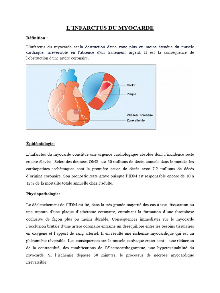 L'Infarctus Du Myocarde | PDF | Infarctus du myocarde | Athérosclérose