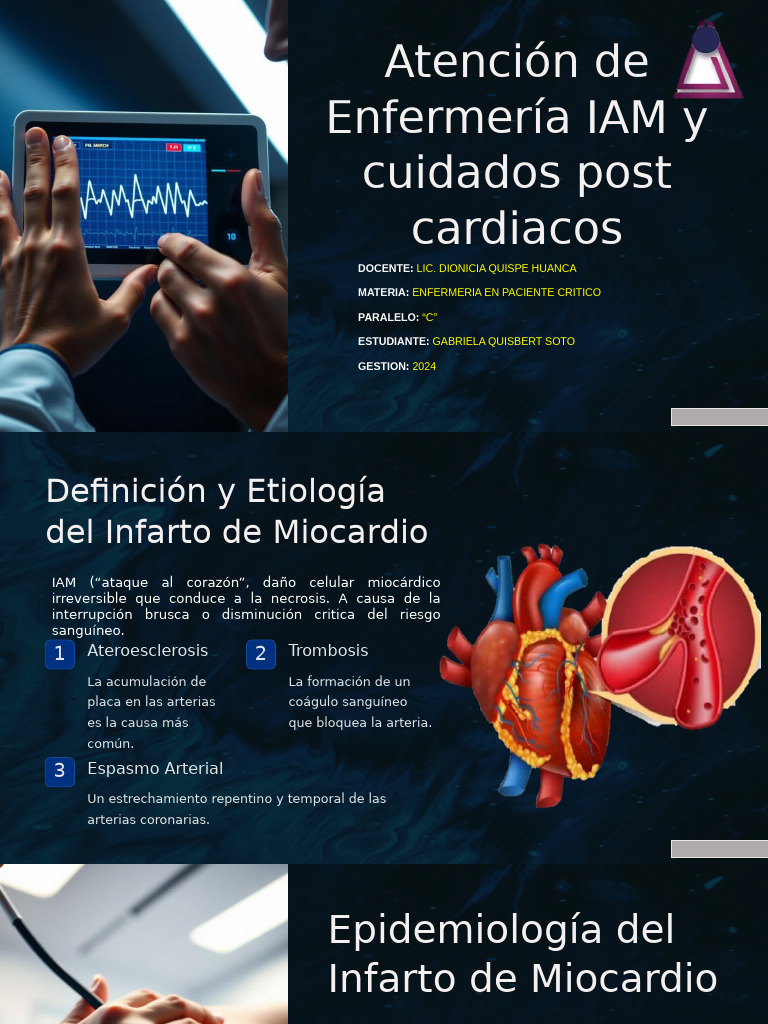 Cuidados de Enfermería en IAM y Post-Cuidados | PDF | Infarto de ...