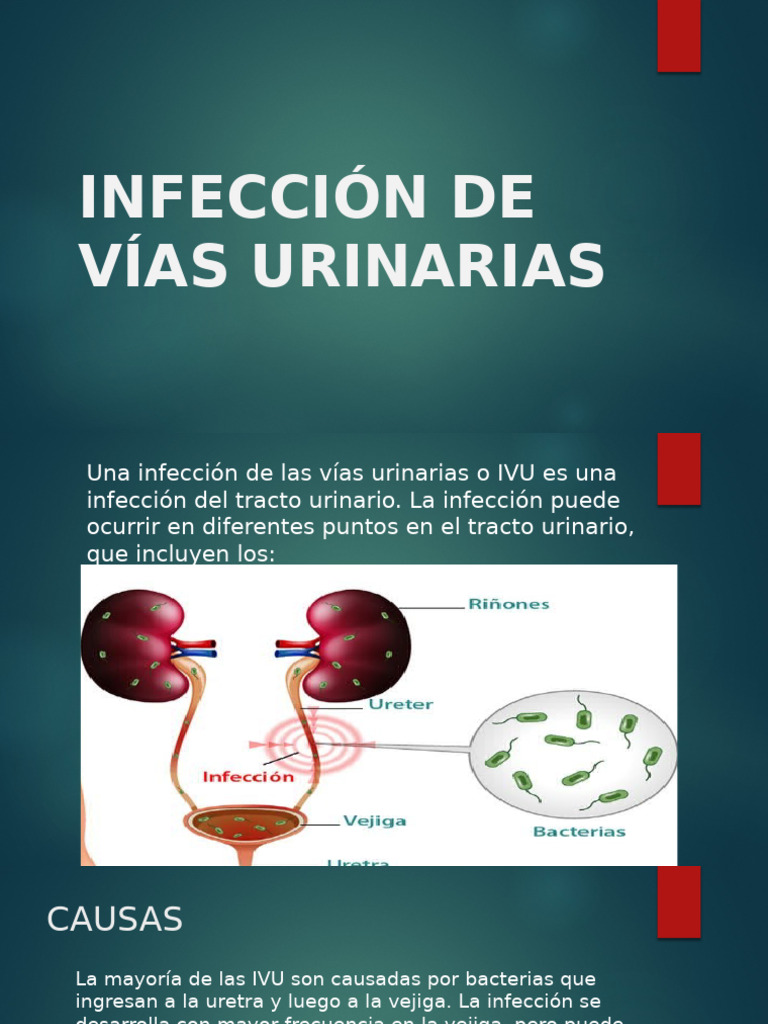 Guía Completa sobre Infecciones Urinarias | PDF | Sistema urinario ...