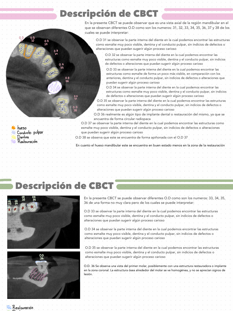 Análisis CBCT de dientes mandibulares | PDF | Diente | Esmalte de dientes