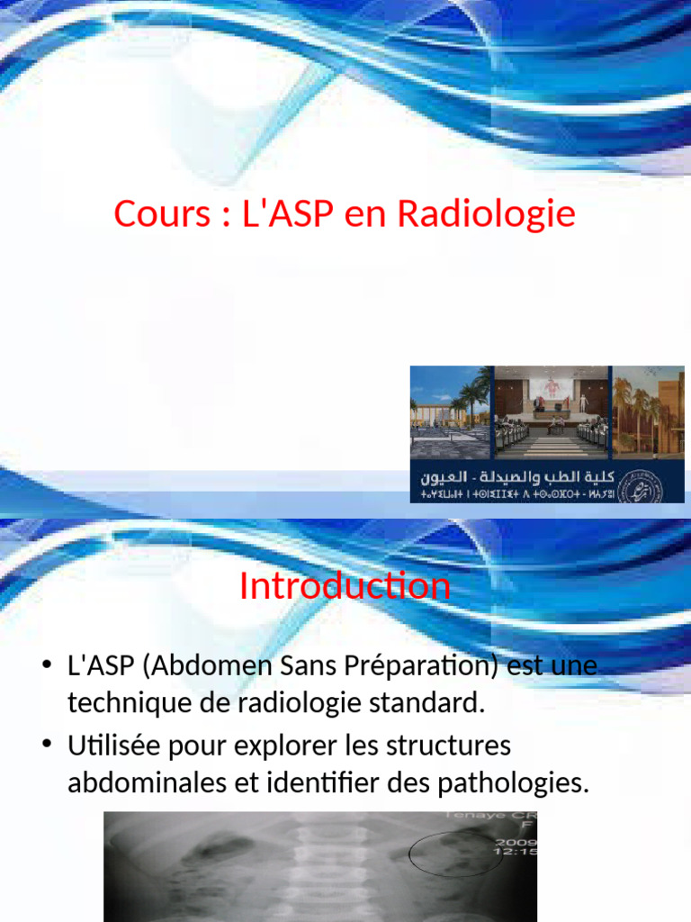 L'ASP en Radiologie : Guide Pratique | PDF | Radiographie | Spécialités ...