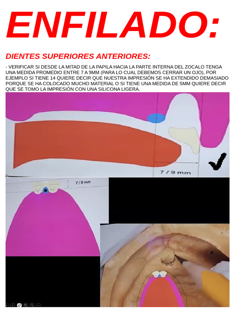 Pautas para El Enfilado y Acrilizado | PDF | Boca | Anatomia dental
