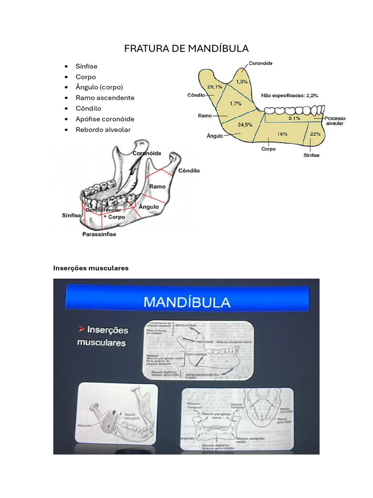 FRATURA DE MANDÍBULA_241108_200637 | PDF | Anatomia humana | Medicina ...