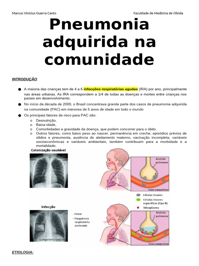 Pneumonia Adquirida na Comunidade em Crianças | PDF | Pneumonia | Remédio