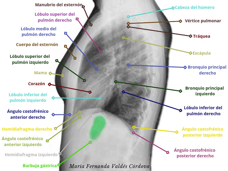 Tele de Tórax. Lateral. María Fernanda Valdés Córdova | PDF