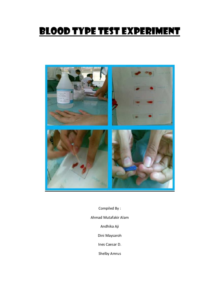 Common Blood Types and Facts | PDF | Blood Type | Pathology
