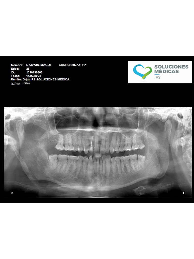 RX PANORAMICA | PDF