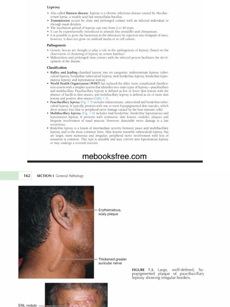 Miscellaneous Topics 2 | PDF