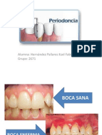 parodoncia terminada