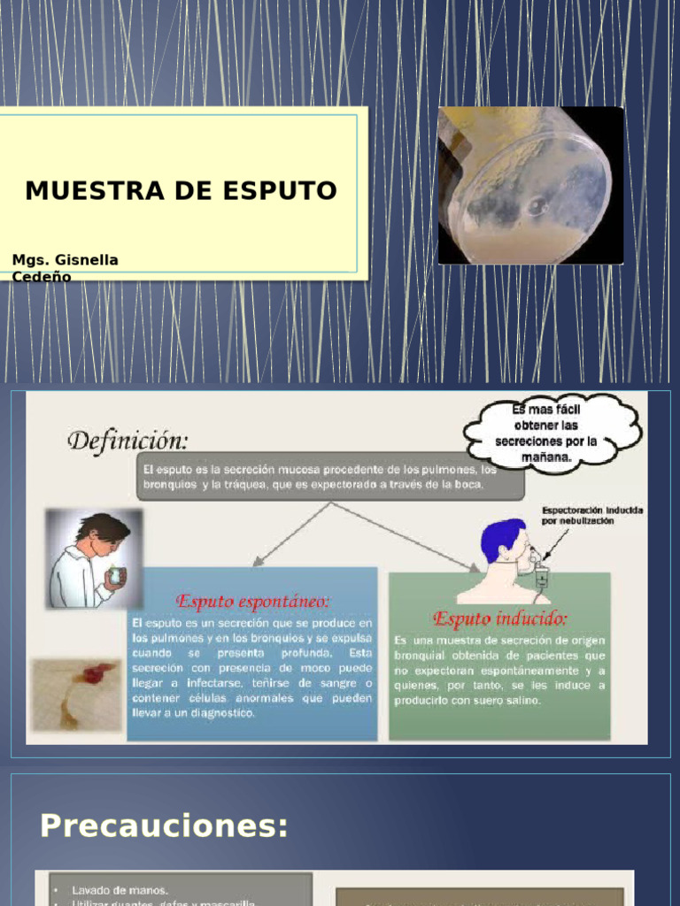 Guía de Procedimientos de Esputo | PDF