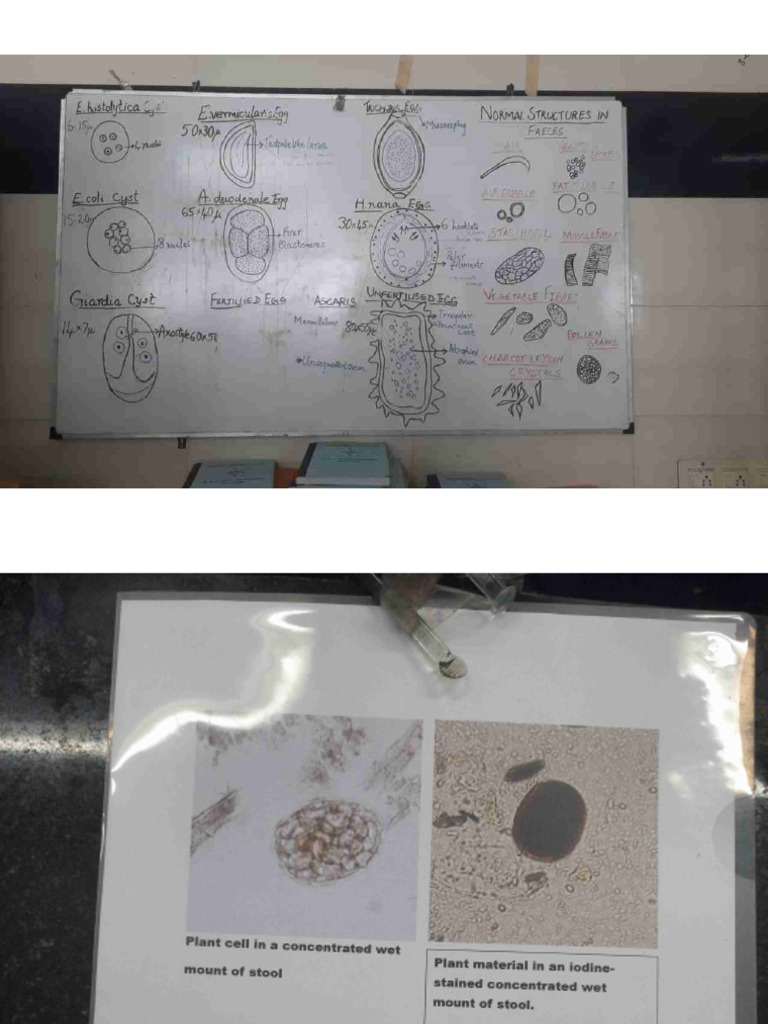 Constituents of Stool | PDF