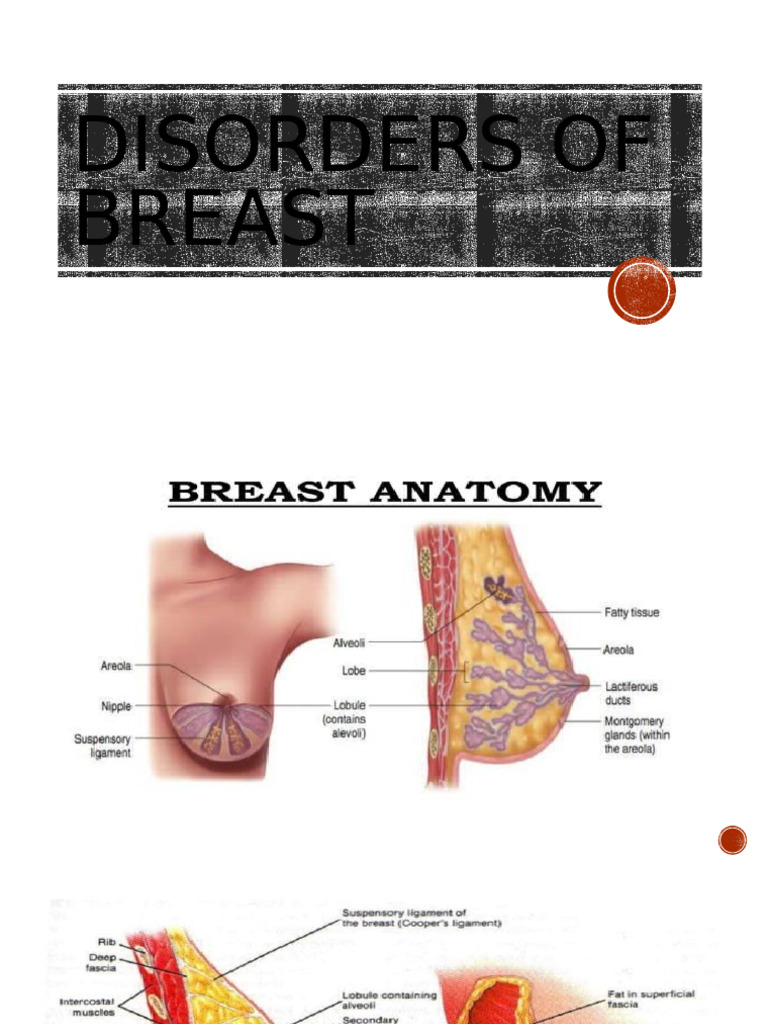 Understanding Mastitis and Breast Abscess | PDF | Secondary Sexual ...