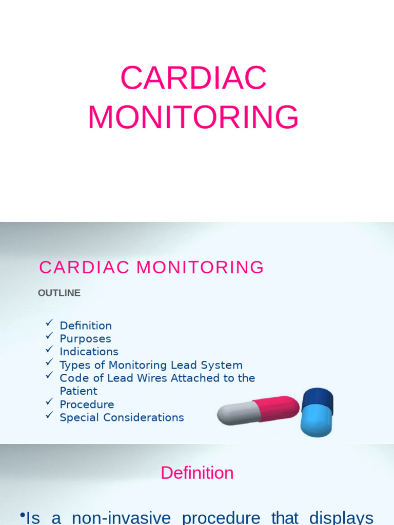 Understanding Cardiac Monitoring ECG | PDF | Heart | Monitoring (Medicine)