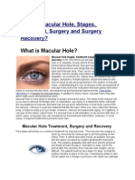 What is Macular Hole, Stages, Treatment, Surgery and Surgery Recovery?
