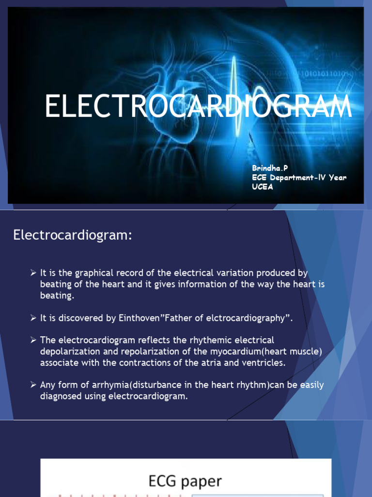 Understanding Electrocardiograms (ECG) | PDF | Electrocardiography ...
