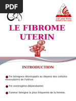 Classification FIGO Des Fibromes Utérins - Embolisation Fibrome Utérin ...