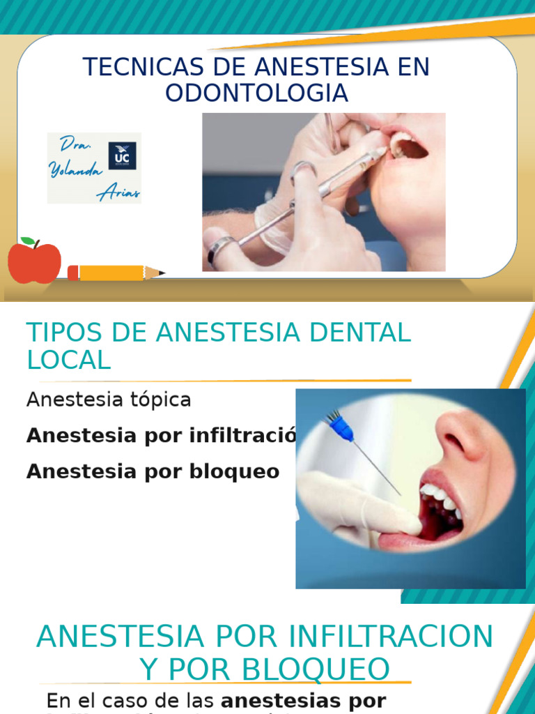 Técnicas de Anestesia Dental Efectivas | PDF | Inyección (medicina)