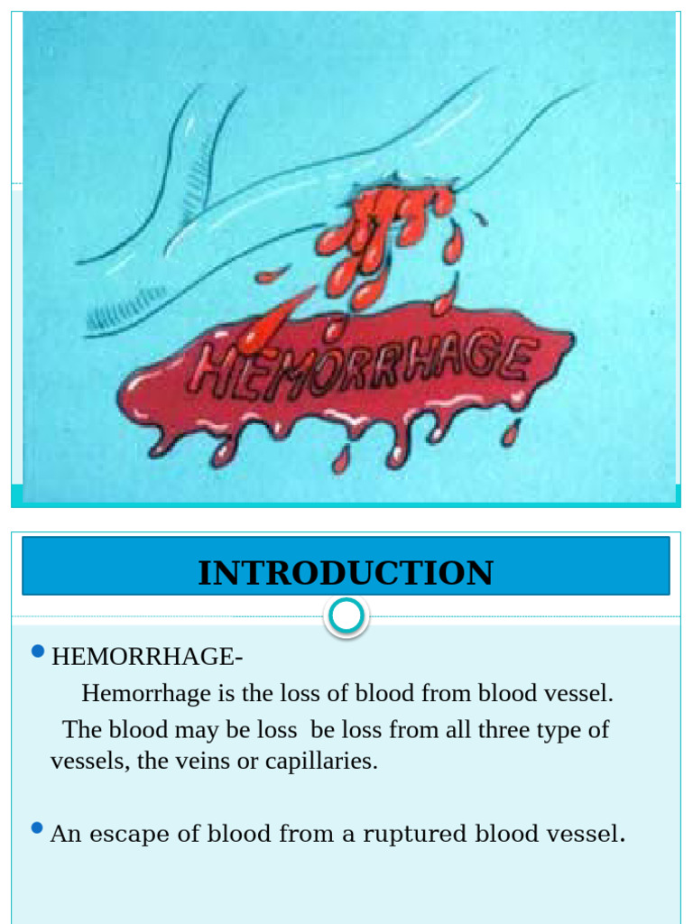 Understanding Hemorrhage and Shock | PDF | Shock (Circulatory) | Heart