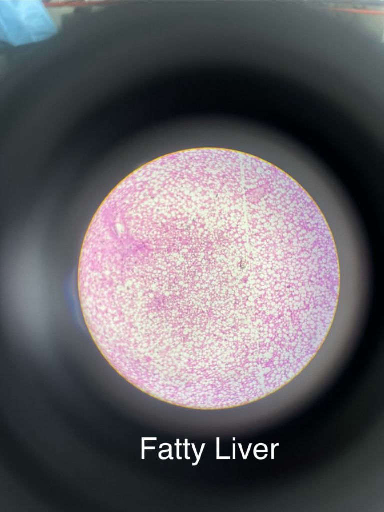 Histopathology Slides | PDF