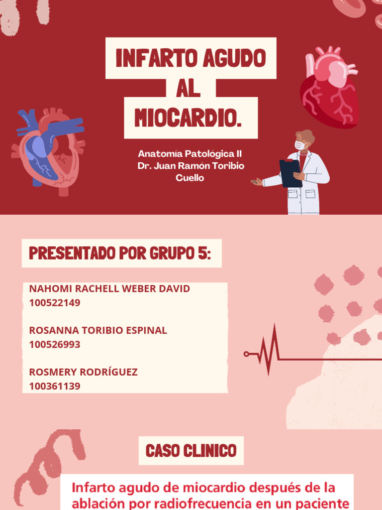 Infarto Agudo de Miocardio: Causas y Tratamiento | PDF | Infarto de ...