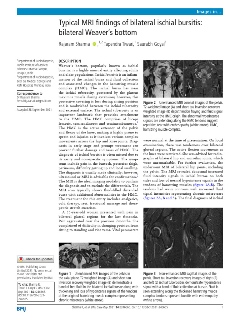 Bilateral Beavers Bottom | PDF | Knee | Pelvis