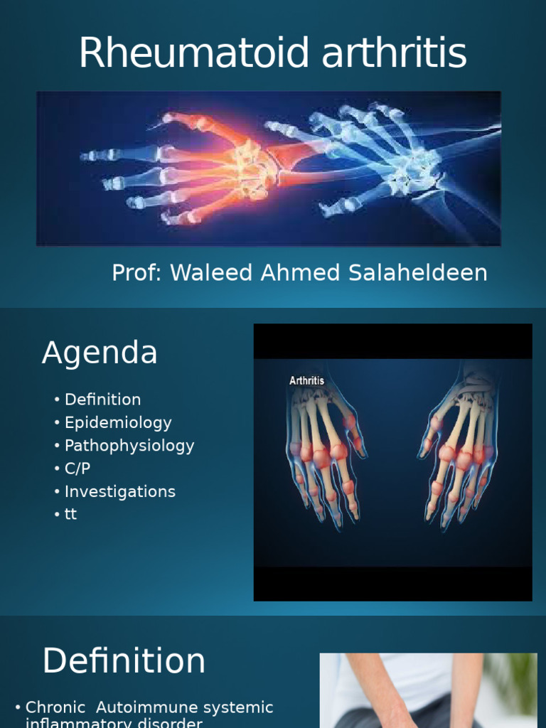 Rheumatoid Arthritis | PDF