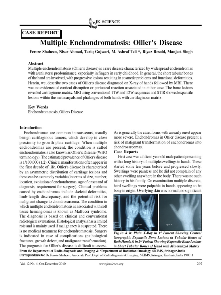 Multiple Enchondromatosis Ollier's Disease | PDF | Medical Specialties ...