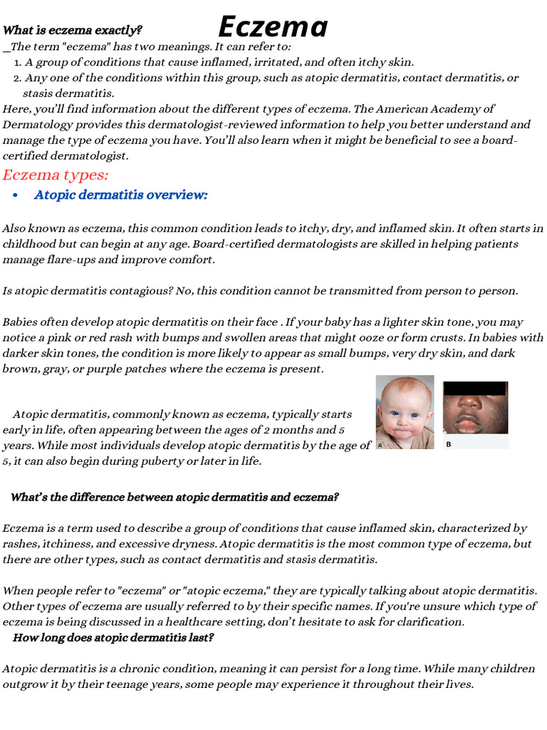 Understanding Eczema Types and Management | PDF | Dermatitis | Allergy