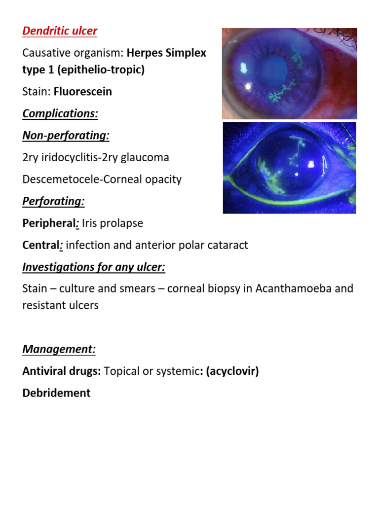 opth. osce | PDF | Cataract | Glaucoma