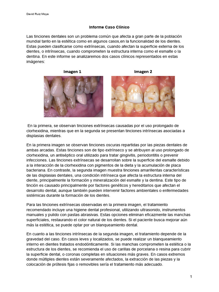 Tinciones Dentales: Extrínsecas vs Intrínsecas | PDF | Diente ...