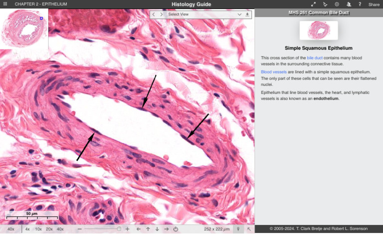 Simple Squamous Epithelium Epithelium 2 | PDF