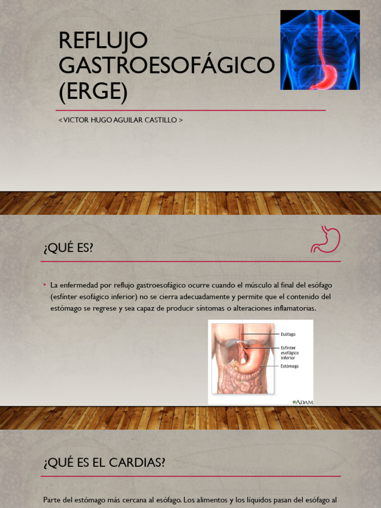 Guía Completa sobre Reflujo Gastroesofágico | PDF | La enfermedad por ...