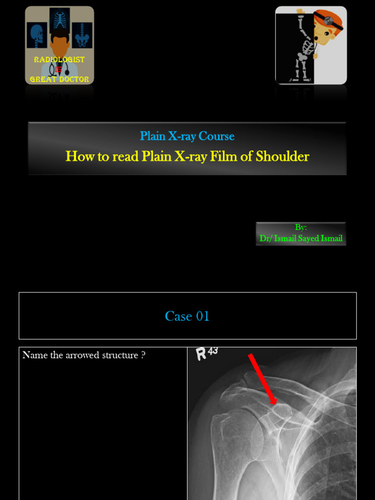 Reading Shoulder X-rays: A Guide | PDF | Shoulder | Musculoskeletal System