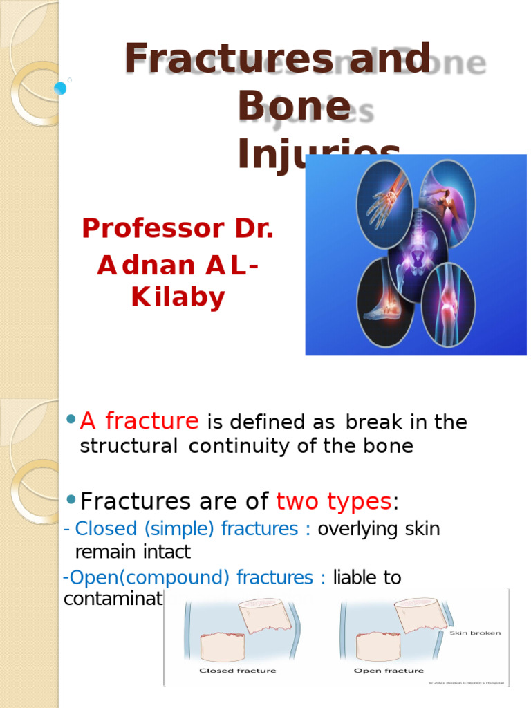 نسخة Fractures and Bone Injuries⁩ 2 | PDF | Bone | Musculoskeletal System