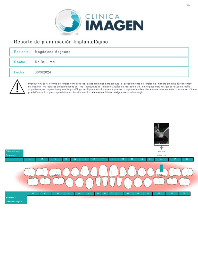 Magnone | PDF