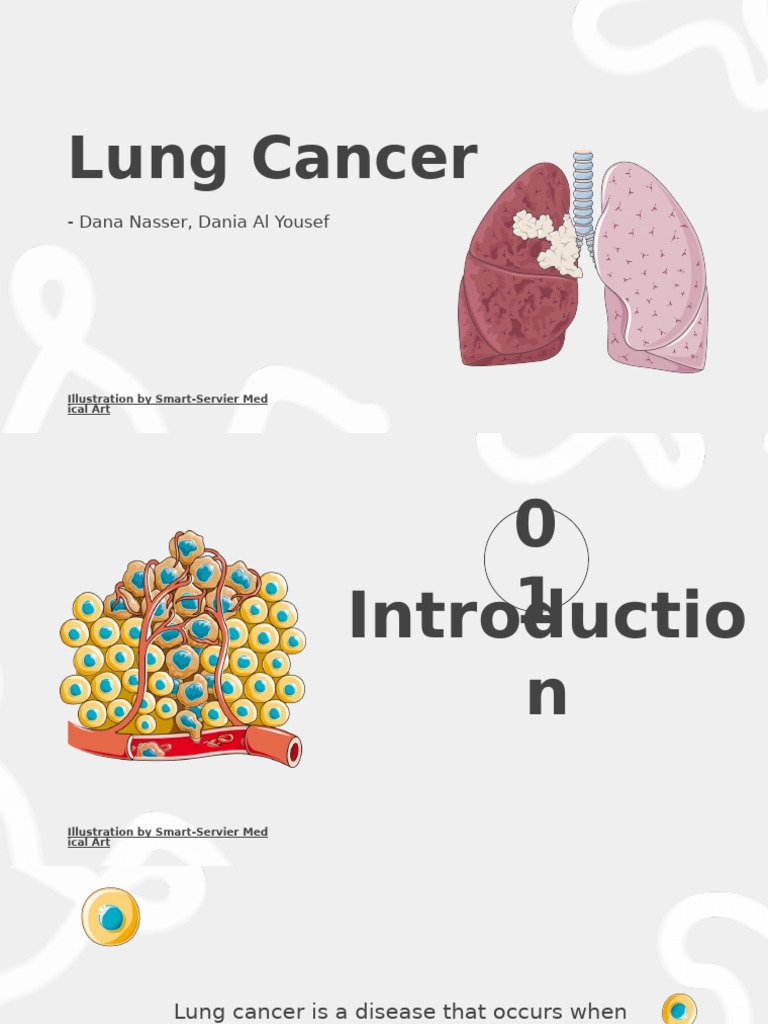 Lung Cancer Disease | PDF | Lung Cancer | Cancer