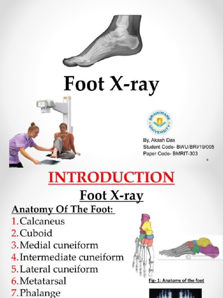 Foot X-Ray Positioning | PDF